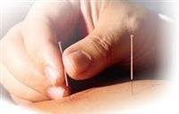 Chinese acupuncture in the ear