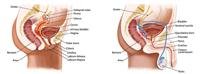Urinary tract infection (UTI).