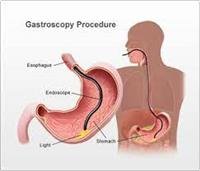 Gastroscopy (endoscopy)