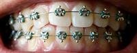 What is orthodontics?
