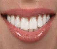 Dental Health and Dentures