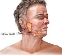Mumps.