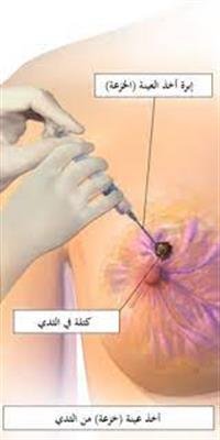 Life After Surgery