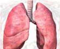 lung transplant