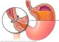 What are the symptoms of congenital heart disease?