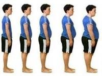 What is Morbid Obesity?