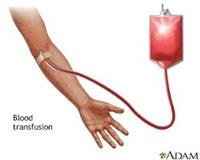 Blood Transfusions