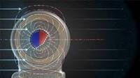 MRI Best for Cochlear Implant Diagnosis