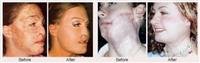 Reconstructiv Surgery
