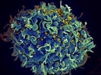 How Close Are We to an HIV Vaccine?