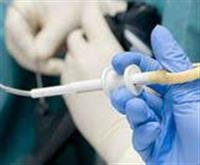 breast biopsy,,,,,
