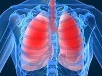 Bronchitis symptoms