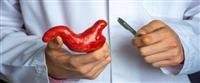 The difference between gastrectomy and sleeve