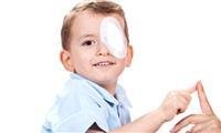 Blocked tear ducts may be associated with a lazy