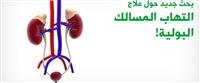 الساركويد