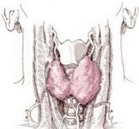 Woman's Thyroid Tumor