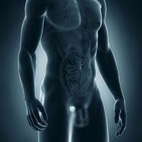Benign Prostate Hypertrophy