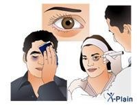 Eyelid lift surgery