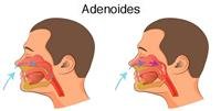Why are adenoids important?