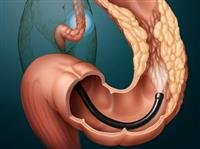 Digestive system binoculars ... Learn about their