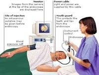 Endoscopy