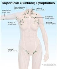 Swollen Lymph Nodes