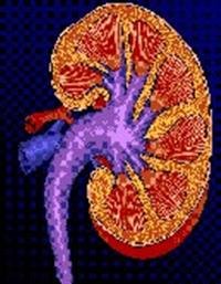Kidney Stones Tied to Raised Heart Disease Risk in