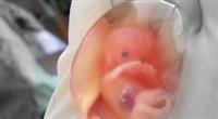 Ultrasound examination