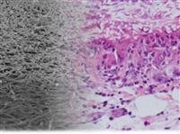 Artificial blood vessels