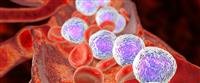 Lymphoma