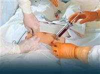 Bone marrow transplant.