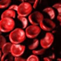 Leukemia