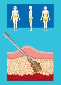 communicable diseases