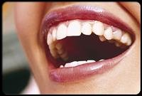 Secrets to Brighter, Whiter Teeth