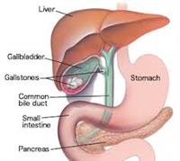 Laparoscopic Surgery for Digestive Problems