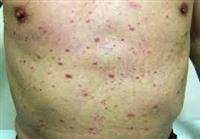 Saudi researcher expects complications after