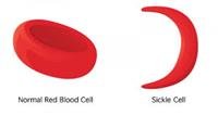 Sickle cell disease: preventing problems and stayi