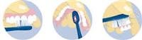 Caring for Your Dentures