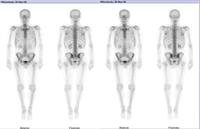 Nuclear Medicine