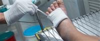 Diabetic foot symptoms and complications,,