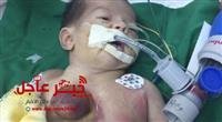The birth of a baby girl with an external heart