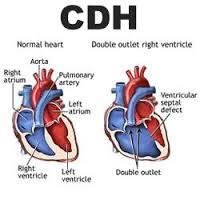 Congenital Heart Disease