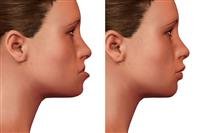 5 "sudden" warning signs of lung cancer we often