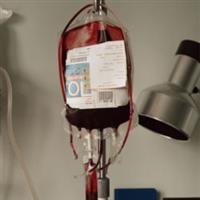 Epilepsy in children