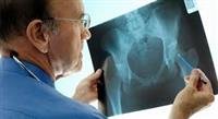 Preparing for a bone scan with radioisotopes