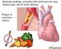High Blood Pressure and Heart Failure