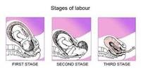 Normal Labor and Delivery Process