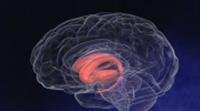 Deep Brain Stimulation May Help in Early Stages of