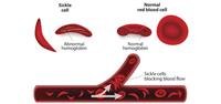 Types of Blood Disorders.