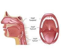 tonsillectomy,